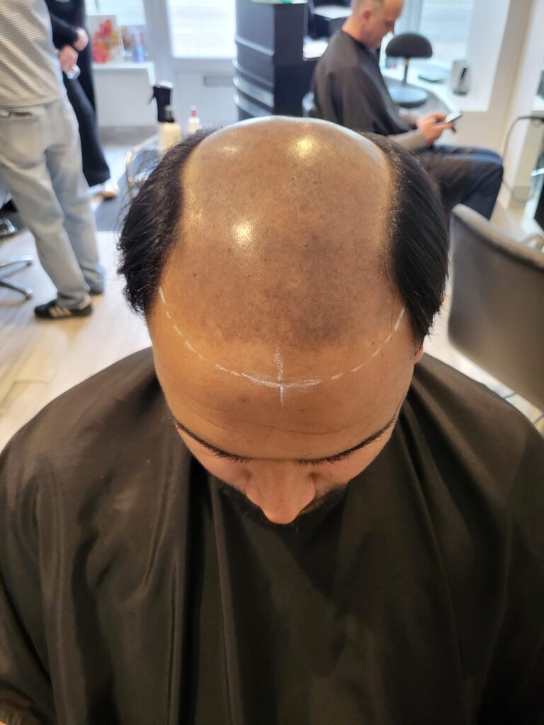 Novo cobelo, hair system, logo, toupee, mens, short hair, hair loss, male balding, receeding hairline,